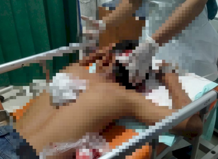 Tampak bagian kepala korban bocor saat mendapatkan perawatan medis di RSUD Lebong/Ist